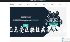 如何保护自己免受区块链